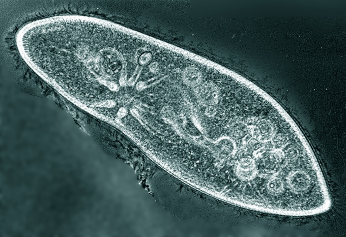 Infuzoria poate fi văzută sub microscop